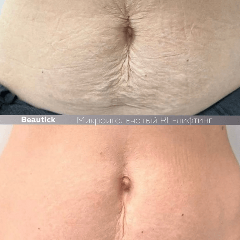 Аппаратная косметология