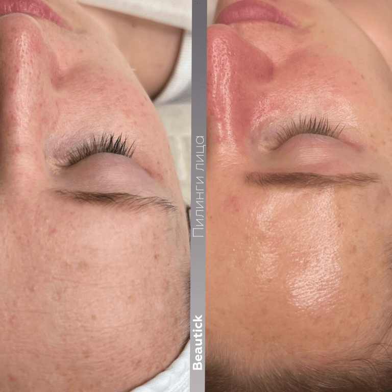 Эстетическая косметология