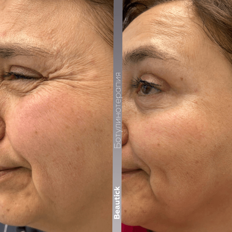 Инъекционная косметология