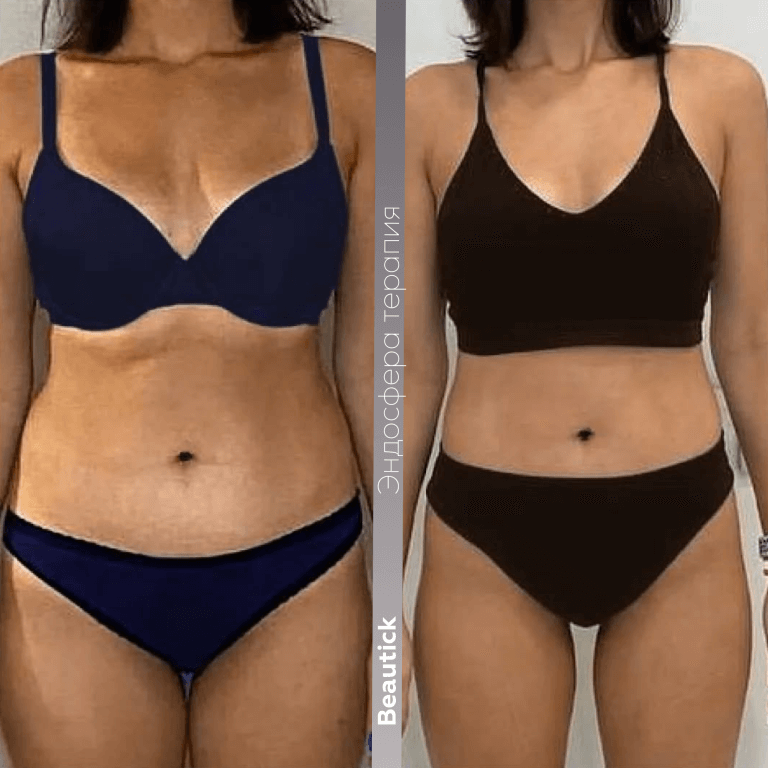 Аппаратная косметология