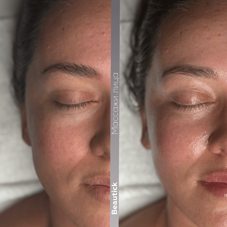 Массажи лица