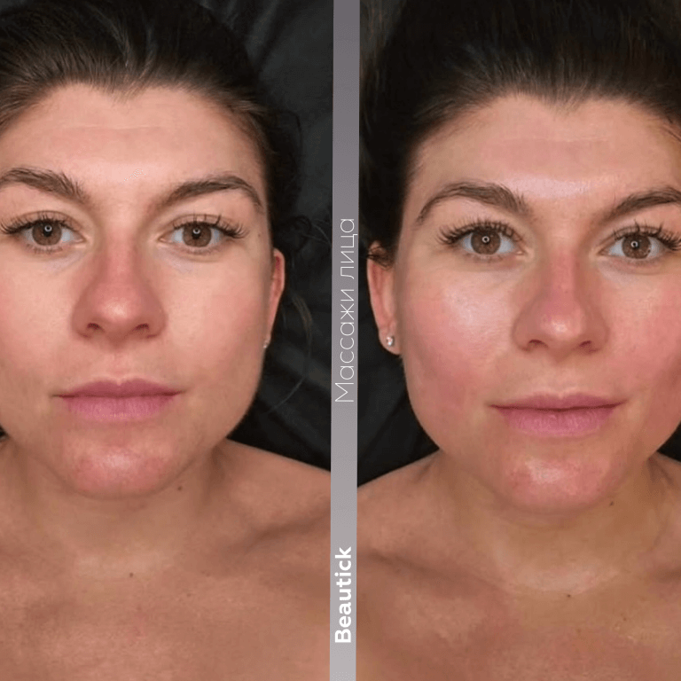 Массажи лица