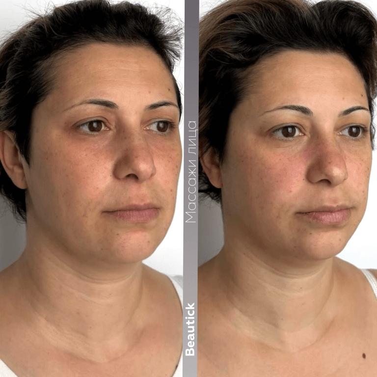 Массажи лица