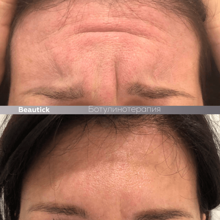 Инъекционная косметология