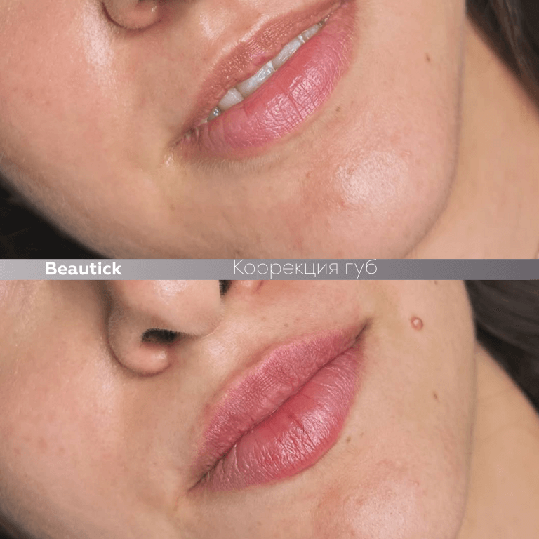 Инъекционная косметология