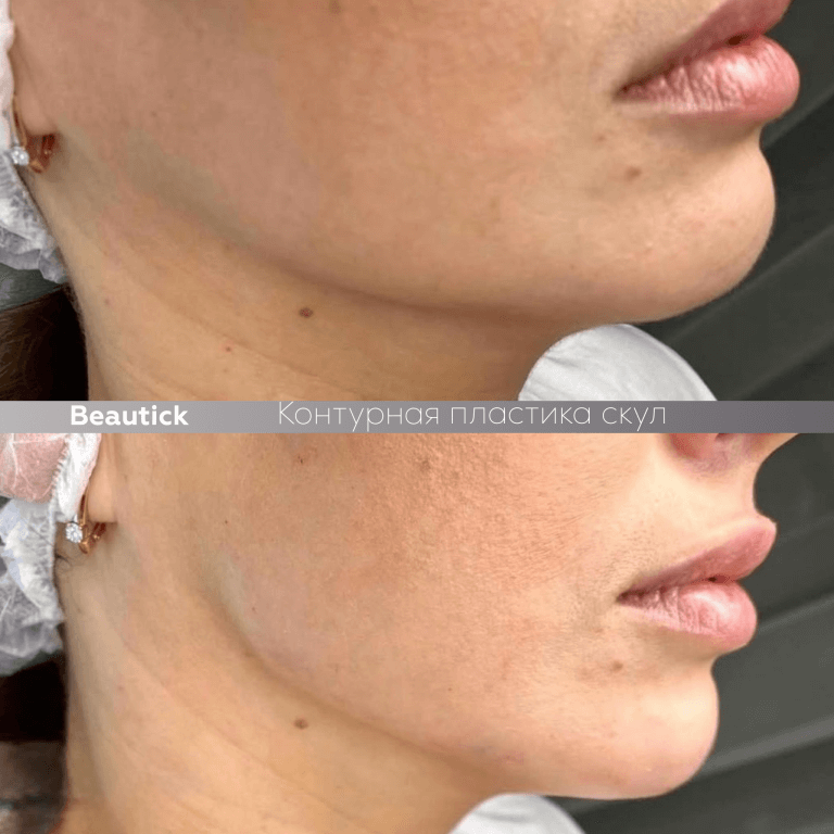 Инъекционная косметология