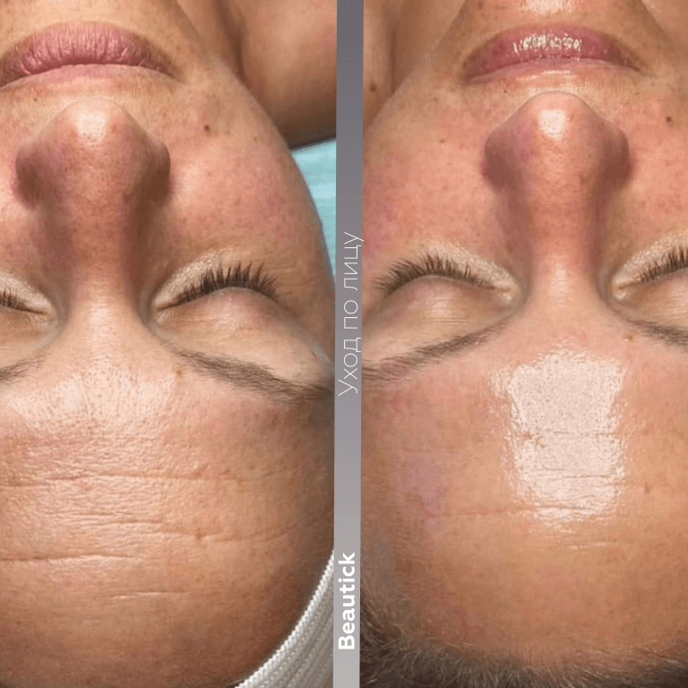 Уходы по лицу