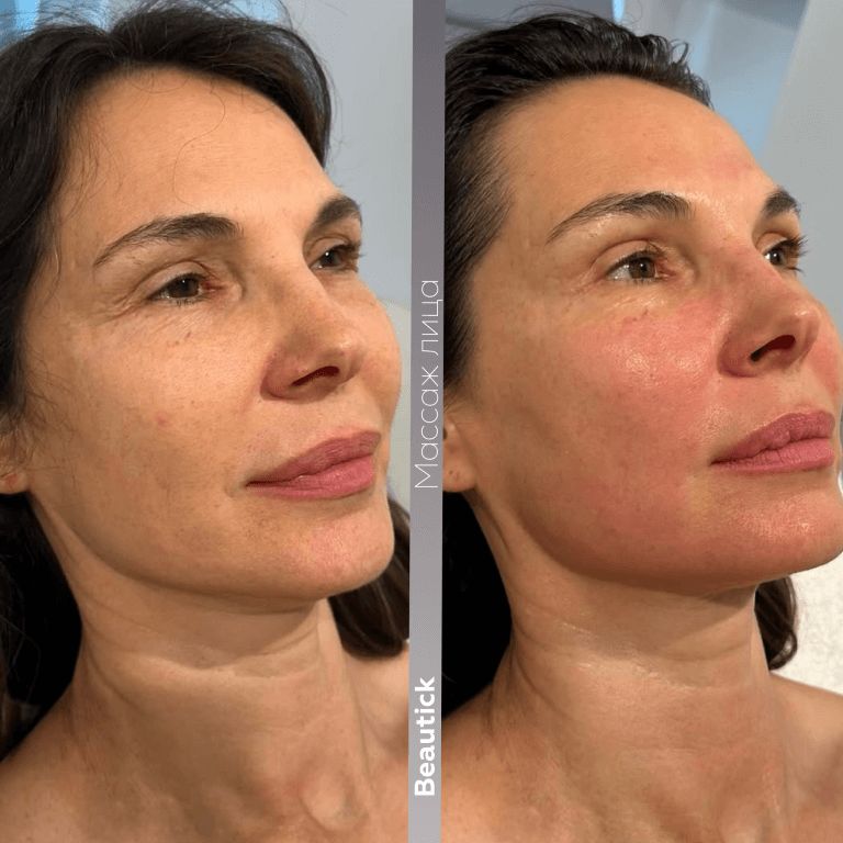 Массажи лица