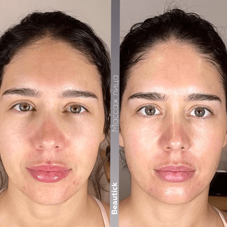 Массажи лица