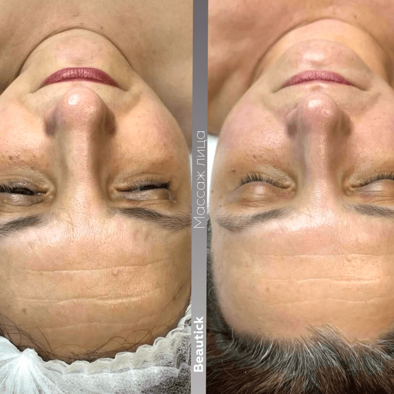 Массажи лица