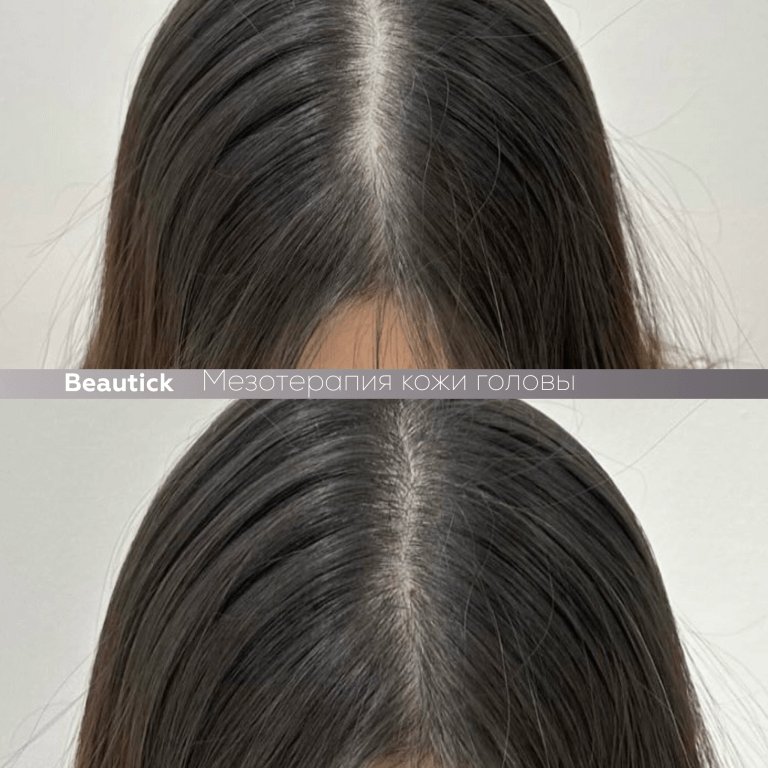 Инъекционная косметология