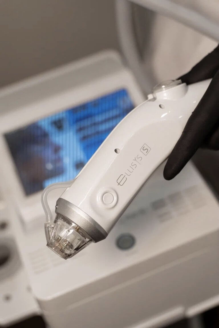 Микроигольчатый RF-лифтинг